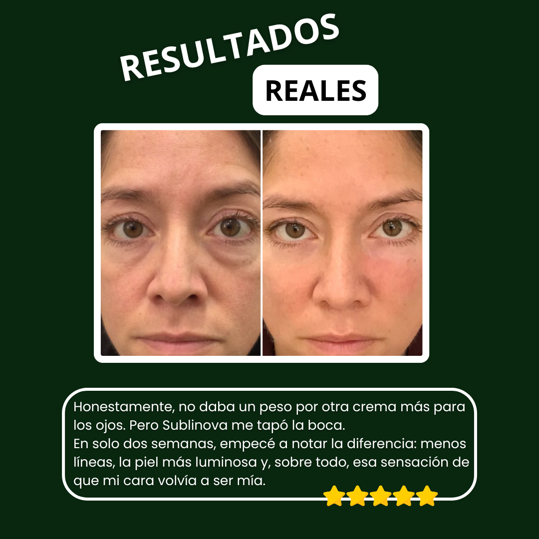 Sublinova: Reduce la hinchazón, las arrugas y las ojeras.